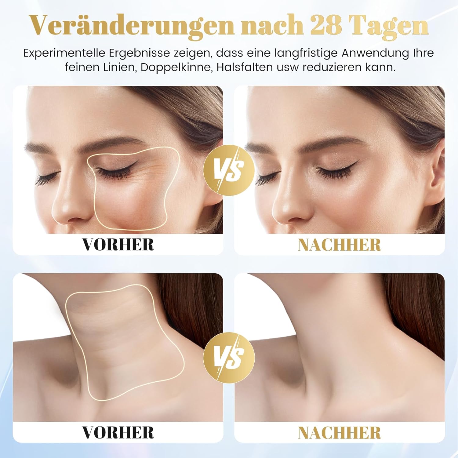 Masajeador facial antiarrugas con eliminación de doble mentón, masaje facial EMS para hombre y mujer, dispositivo de cara en V, dispositivo para tonificar la piel y levantar, mejorar,